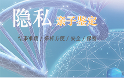 重庆做隐私亲子鉴定一般多久可以拿到结果，重庆隐私亲子鉴定办理条件