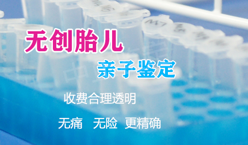 重庆孕期亲子鉴定流程,重庆孕期亲子鉴定出结果时间 重庆孕期亲子鉴定流程,重庆孕期亲子鉴定出结果时间